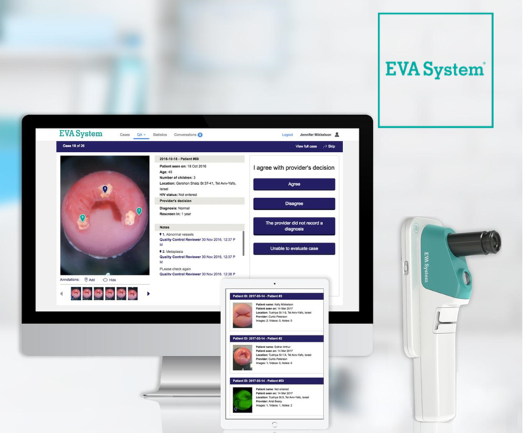 Mobile ODT  created the Enhanced Visual Assessment (EVA) System, an integrated cervical cancer screening and patient tracking system